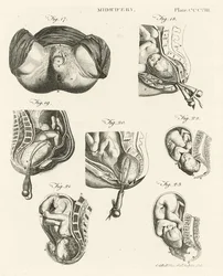 Obstetricia, ilustración de 